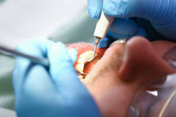 Best Knocked-Out Tooth Emergency  in Brogden, NC