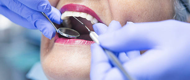 Best Chipped Tooth Repair Near Me  in Brogden, NC